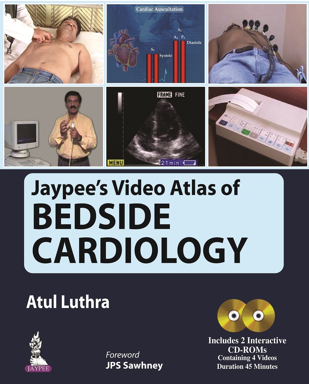 JAYPEE'S VIDEO ATLAS OF BEDSIDE CARDIOLOGY INCLUDES 2 INTERACTIVE CD-ROMS 1ST/2016 - ATUL LUTHRA