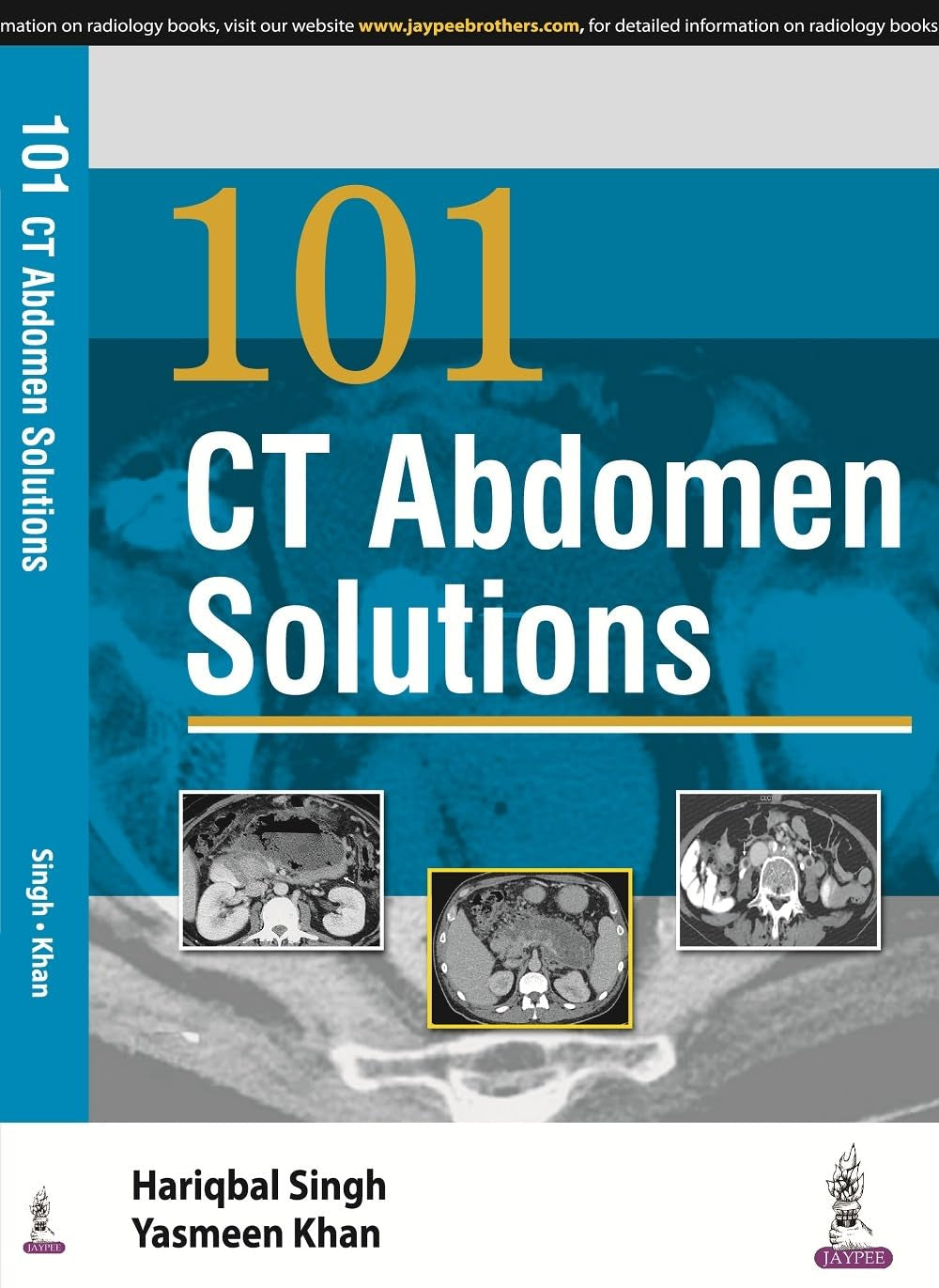 101 CT ABDOMEN SOLUTIONS 1ST/2016 - HARIQBAL SINGH