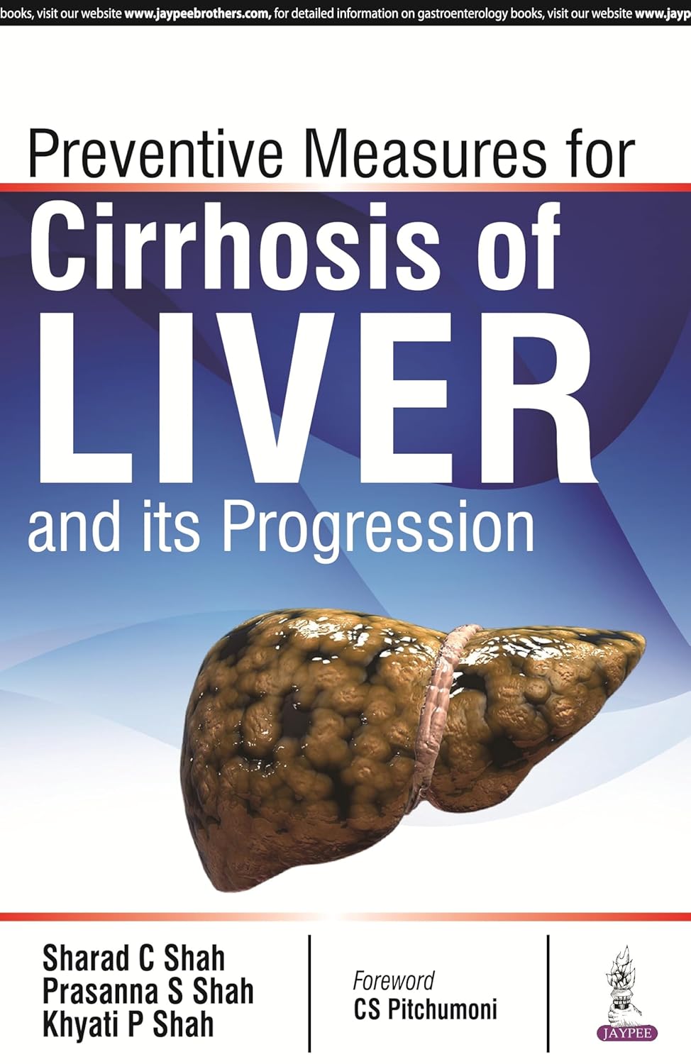 PREVENTIVE MEASURES FOR CIRRHOSIS OF LIVER AND ITS PROGRESSION 1ST/2016 - SHARDA C SHAH