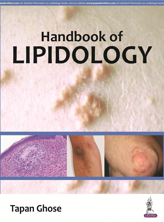 HANDBOOK OF LIPIDOLOGY 1ST/2016 - TAPAN GHOSE