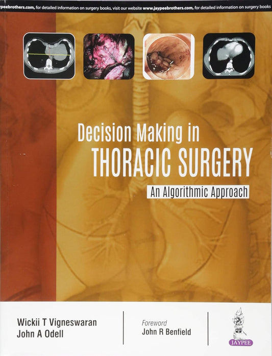 DECISION MAKING IN THORACIC SURGERY AN ALGORITHMIC APPROACH 1ST/2018 - WICKII T VIGNESWARAN