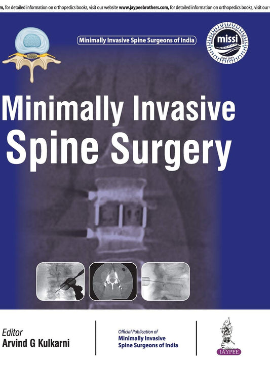 MINIMALLY INVASIVE SPINE SURGERY(OFFICIAL PUBLICATION OF MINIMALLY INVASIVE SPINE SURGEONS OF INDIA) 1ST/2018 - ARVIND G KULKARNI