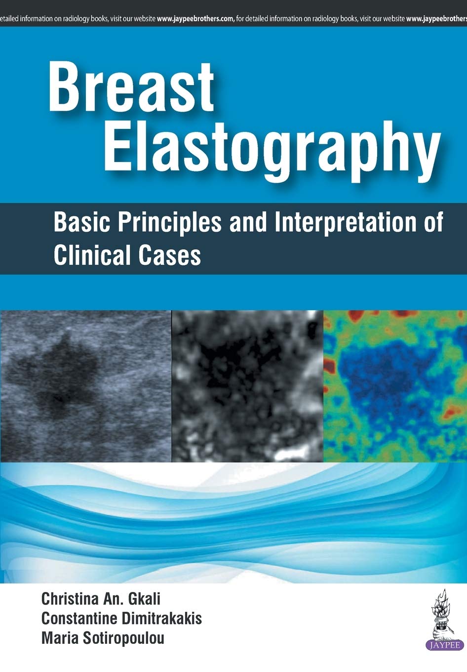 BREAST ELASTOGRAPHY BASIC PRINCIPLES AND INTERPRETATION OF CLINICAL CASES 1ST/2018 - CHRISTINA AN.GKALI