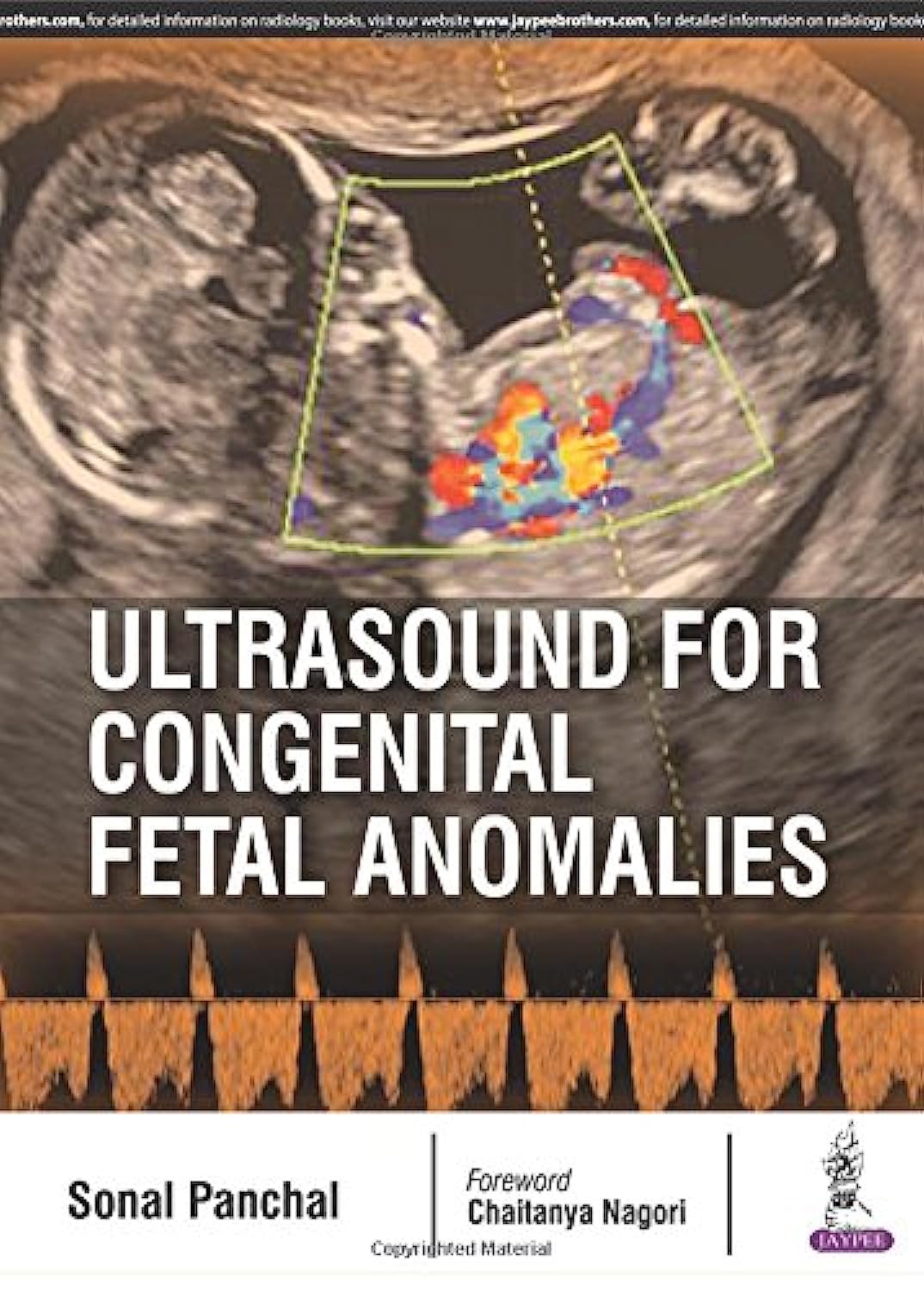 ULTRASOUND FOR CONGENITAL FETAL ANOMALIES 1ST/2017 - SONAL PANCHAL