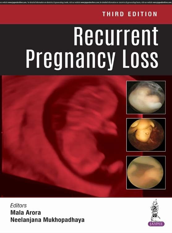 RECURRENT PREGNANCY LOSS 3RD/2018 - MALA ARORA