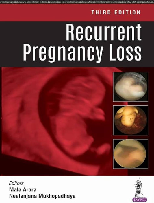 Recurrent Pregnancy Loss 3RD/2018