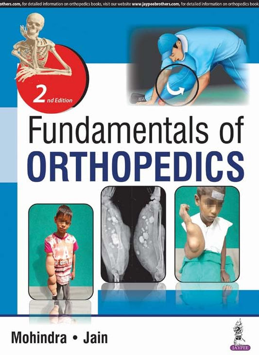 FUNDAMENTALS OF ORTHOPEDICS 2ND/2018 - MUKUL MOHINDRA