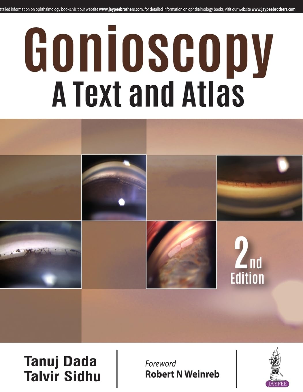 GONIOSCOPY:A TEXT AND ATLAS 2ND/2018 - TANUJ DADA