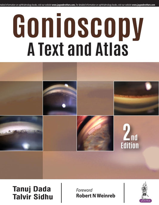 GONIOSCOPY:A TEXT AND ATLAS 2ND/2018 - TANUJ DADA