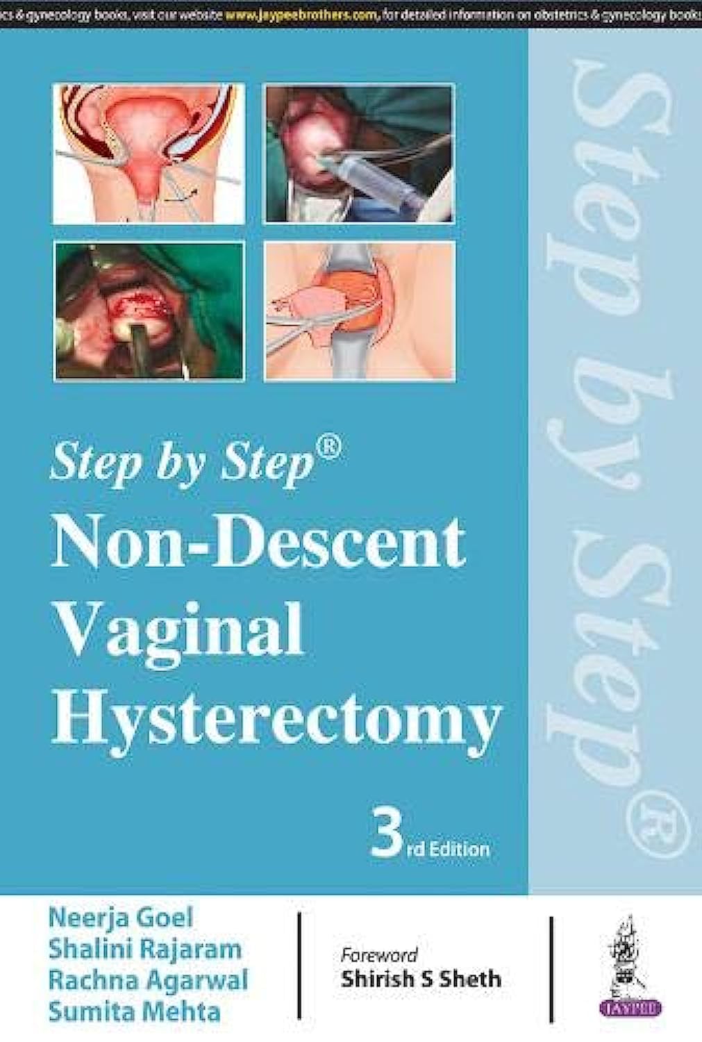 STEP BY STEP NON-DESCENT VAGINAL HYSTERECTOMY 3RD/2018 - NEERJA GOEL
