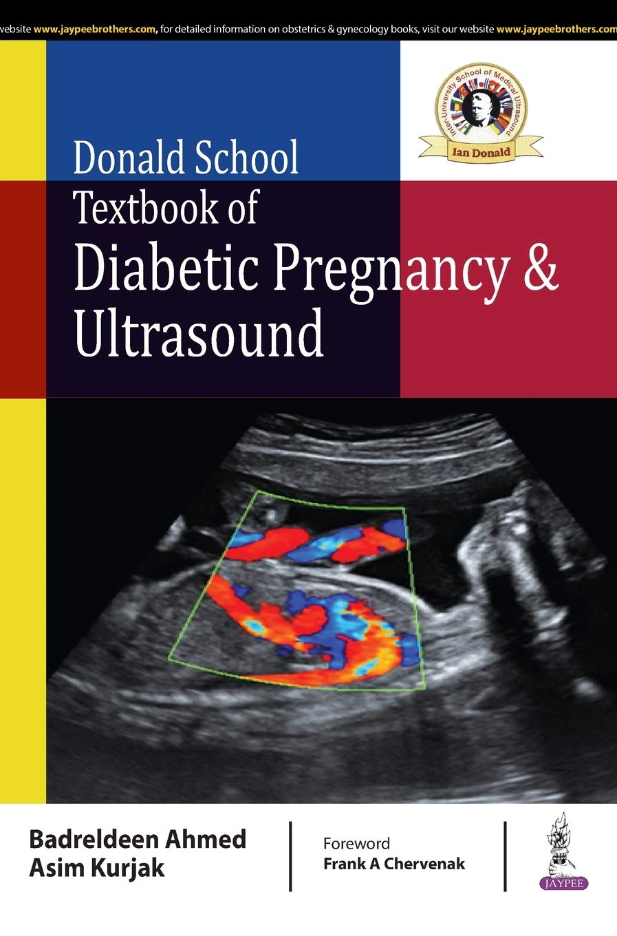 DONALD SCHOOL TEXTBOOK OF DIABETIC PREGNANCY & ULTRASOUND 1ST/2018 - AHMED BADRELDEEN