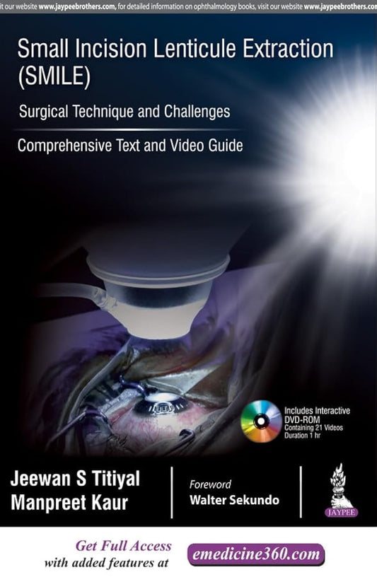 SMALL INCISION LENTICULE EXTRACTION (SMILE) SURGICAL TECHNIQUE AND CHALLENGES:COMPREHENSIVE TEXT 1ST/2018 - JEEWAN S TITIYAL