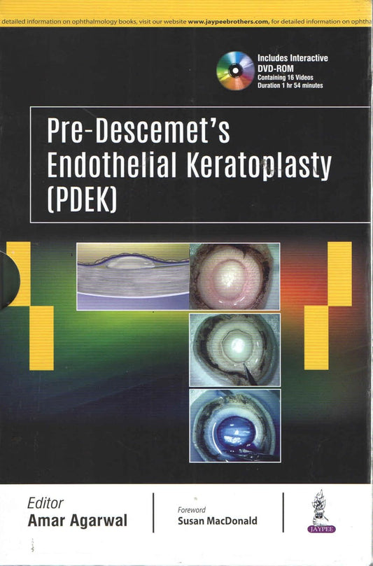 PRE-DESCEMET'S ENDOTHELIAL KERATOPLASTY(PDEK) 1ST/2018 - AMAR AGARWAL