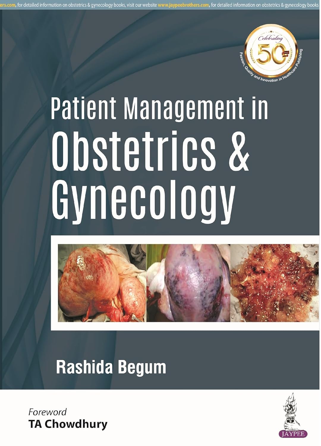 PATIENT MANAGEMENT IN OBSTETRICS & GYNECOLOGY 1ST/2019 - RASHIDA BEGUM