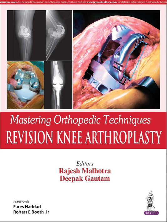MASTERING ORTHOPEDIC TECHNIQUES REVISION KNEE ARTHROPLASTY 1ST/2025 - RAJESH MALHOTRA