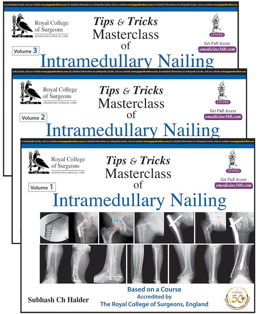 TIPS & TRICKS MASTERCLASS OF INTRAMEDULLARY NAILING (3 VOLUMES): BASED ON A COURSE ACCREDITED BY THE 1ST/2020 - SUBHASH CH HALDER