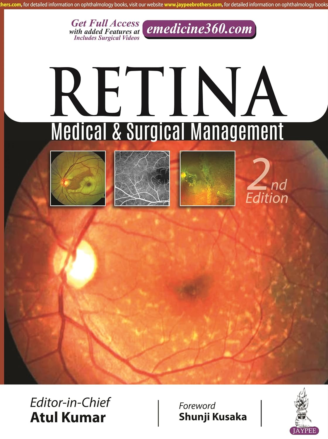 RETINA: MEDICAL & SURGICAL MANAGEMENT 2ND/2022 - ATUL KUMAR