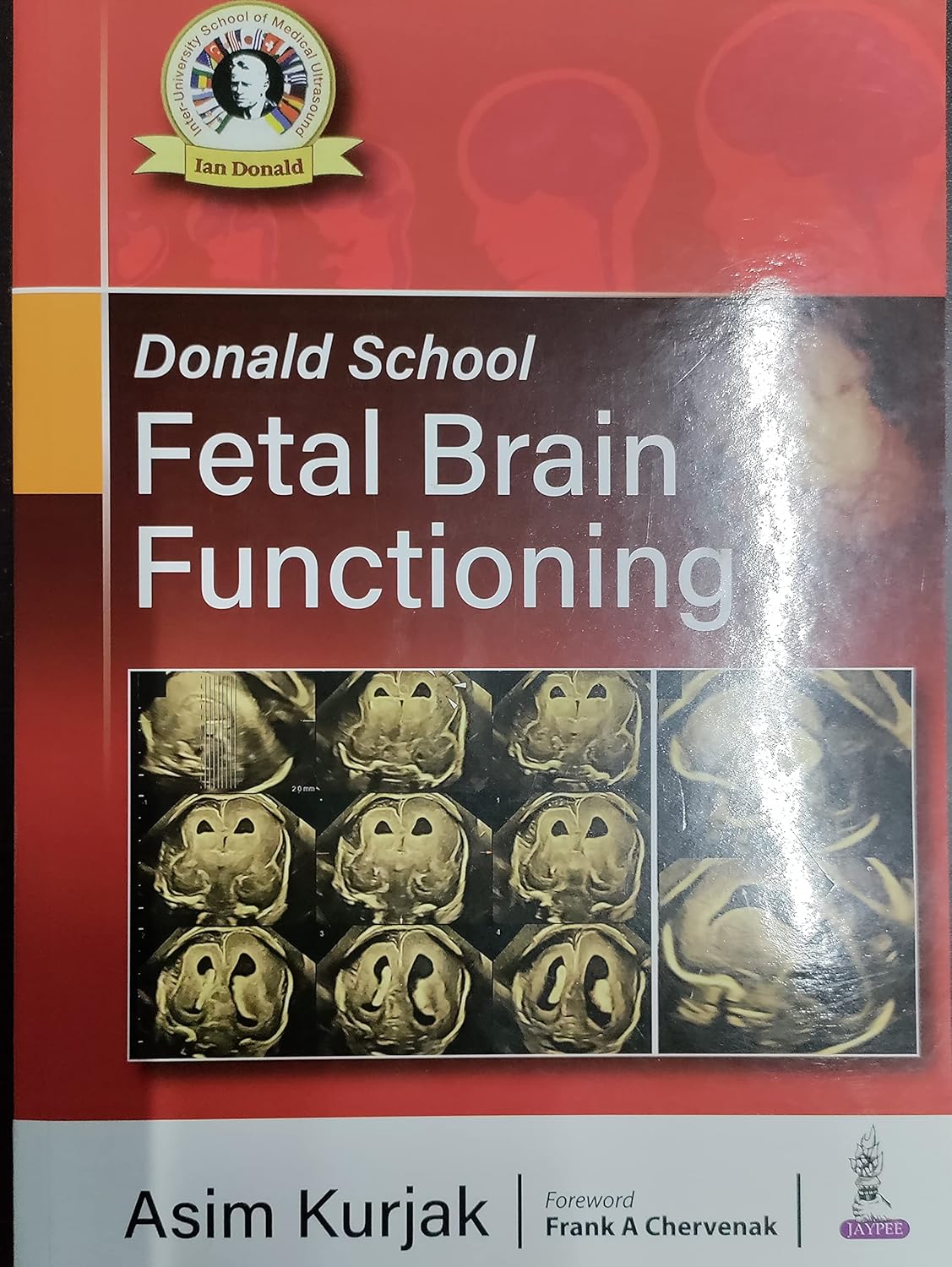 DONALD SCHOOL FETAL BRAIN FUNCTIONING 1ST/2022 - ASIM KURJAK