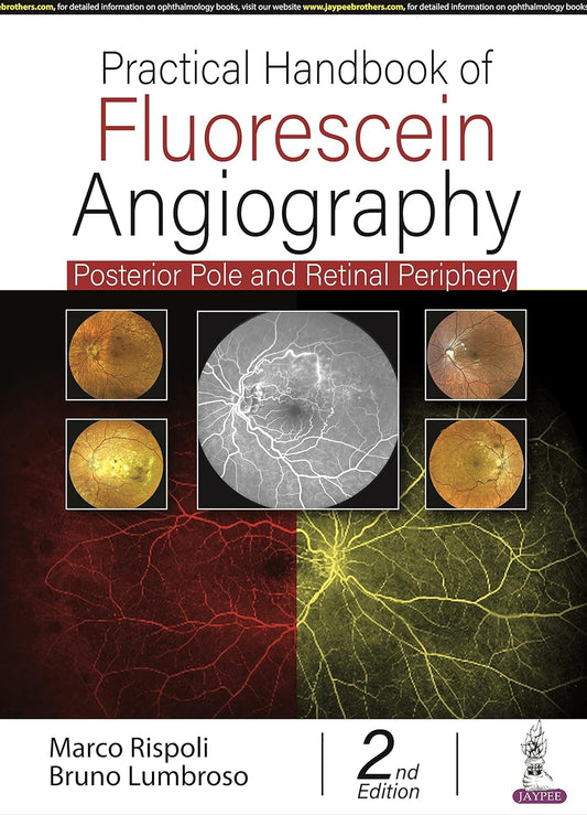 PRACTICAL HANDBOOK OF FLUORESCEIN ANGIOGRAPHY: POSTERIOR AND RETINAL PERIPHERY 2ND/2022 - MARCO RISPOLI