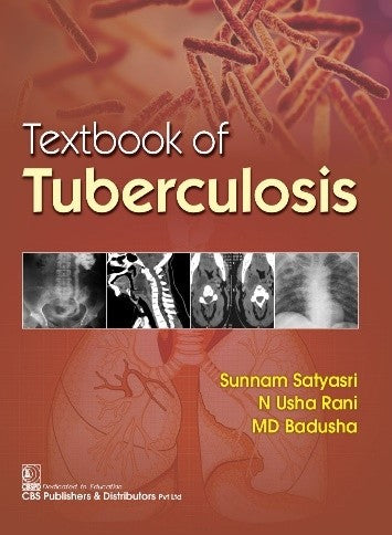 TEXTBOOK OF TUBERCULOSIS 1ST/2023 - SUNNAM SATYASRI
