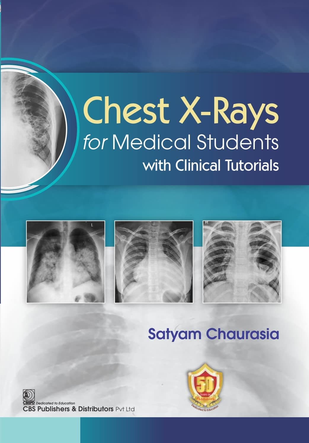 CHEST X RAYS FOR MEDICAL STUDENTS WITH CLINICAL TUTORIALS 1ST/2026 - SATYAM CHAURASIA