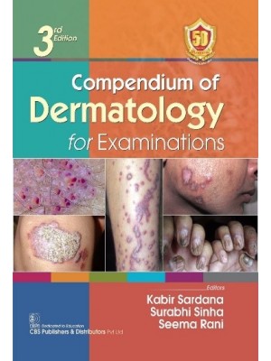 Compendium of Dermatology for Examinations 3rd/2024