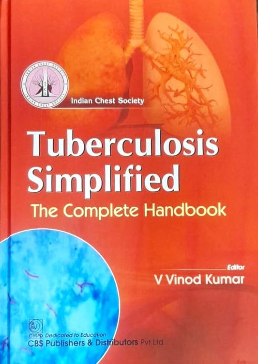 TUBERCULOSIS SIMPLIFIED THE COMPLETE HANDBOOK 1ST/2024 - V VINOD KUMAR