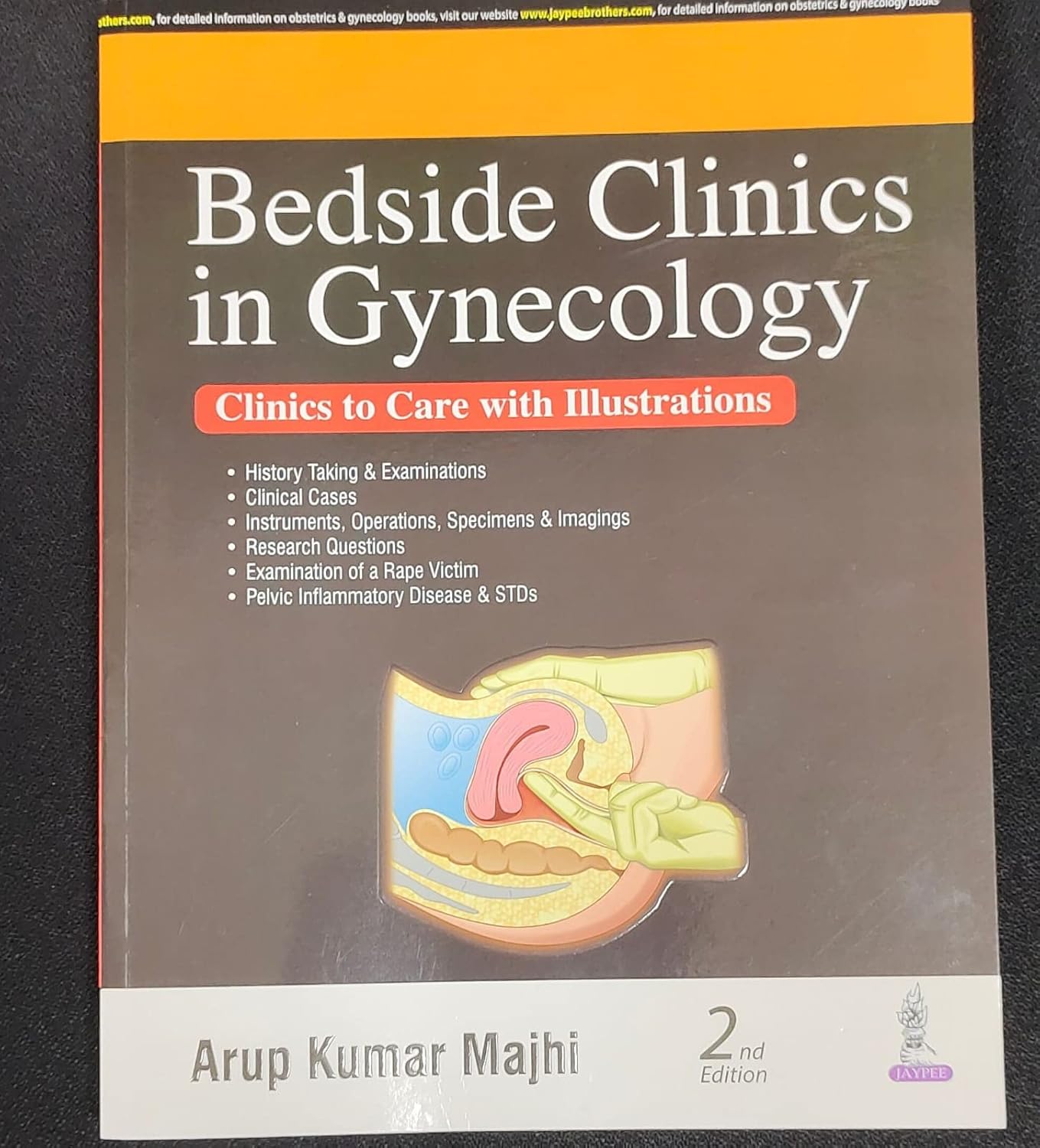 BEDSIDE CLINICS IN GYNECOLOGY 2ND/2025 - ARUP KUMAR MAJHI