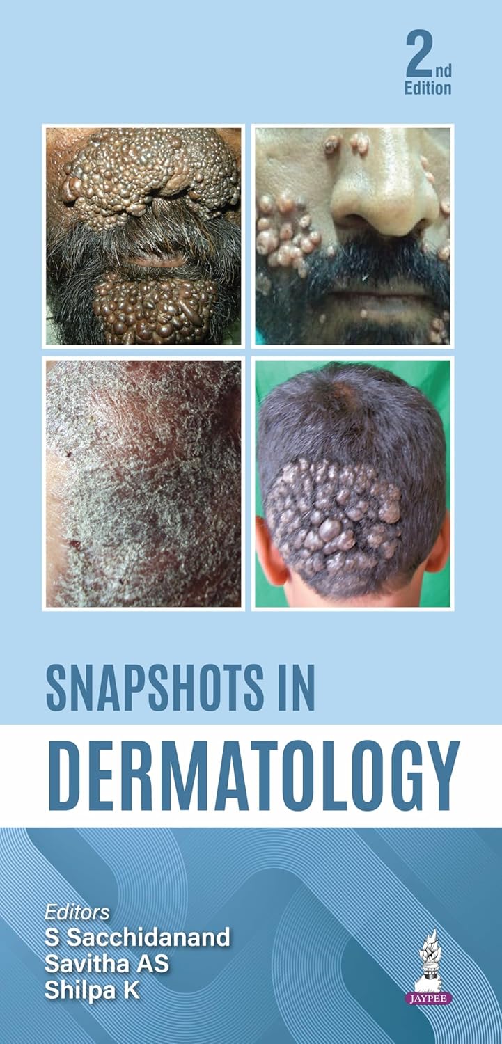 SNAPSHOTS IN DERMATOLOGY 2ND/2026 - S SACCHIDANAND