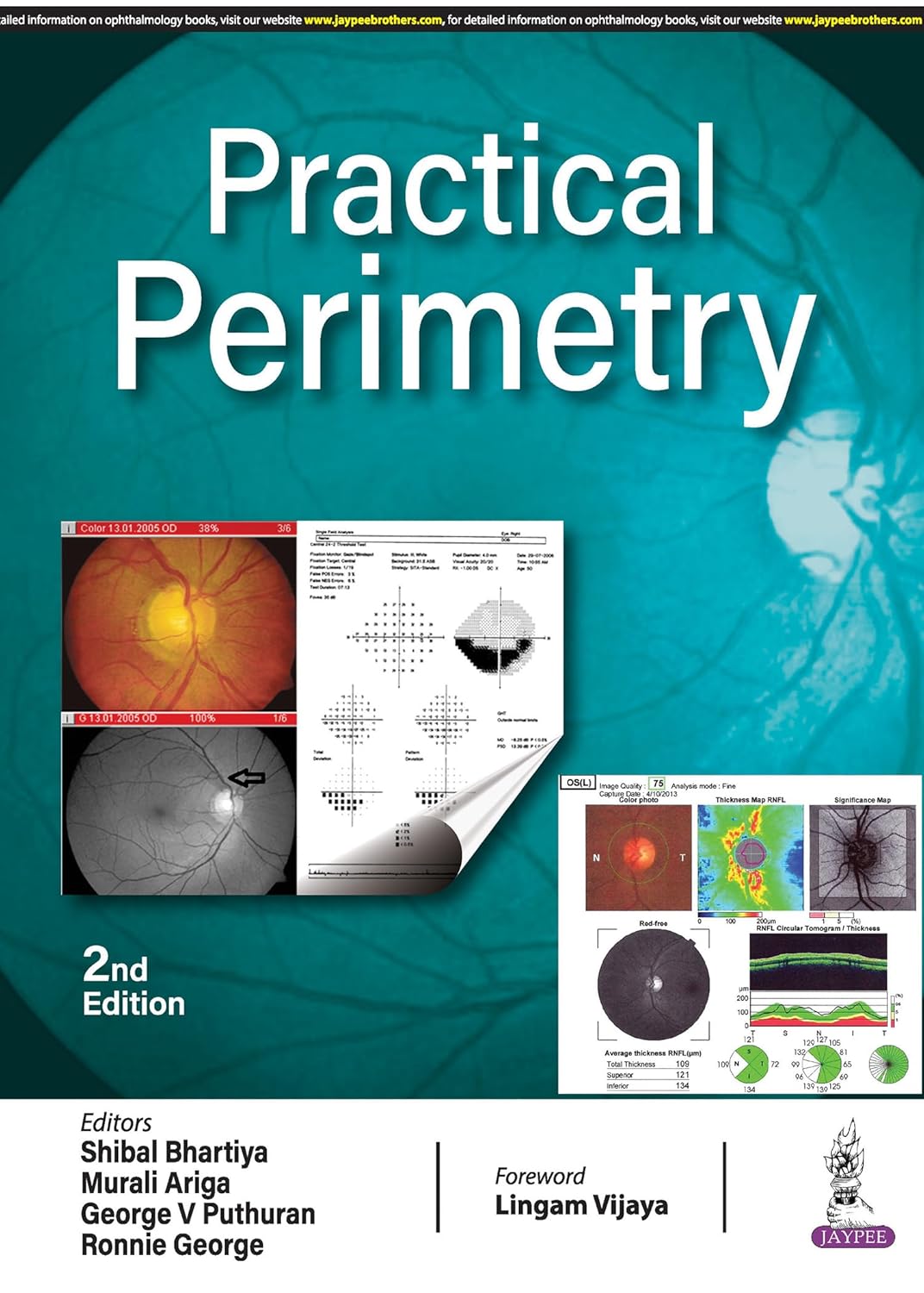 PRACTICAL PERIMETRY 2ND/2024 - SHIBAL BHARTIYA