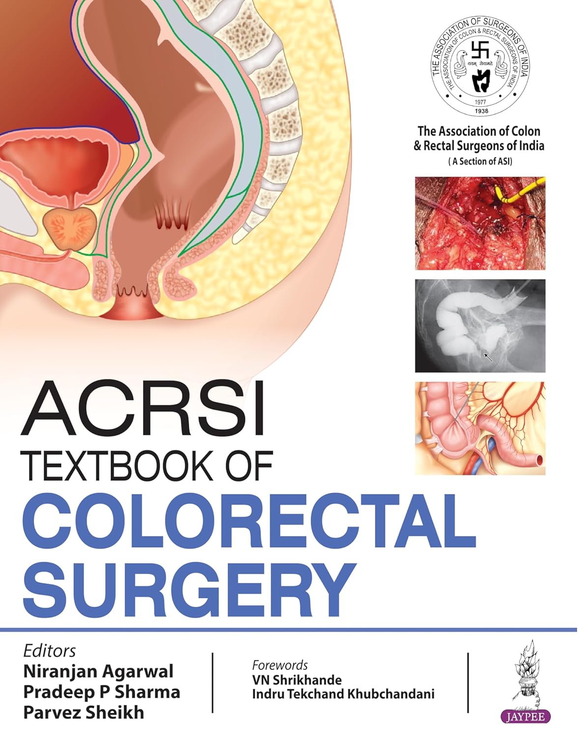 ACRSI TEXTBOOK OF COLORECTAL SURGERY 1ST/2024 - NIRANJAN AGRAWAL