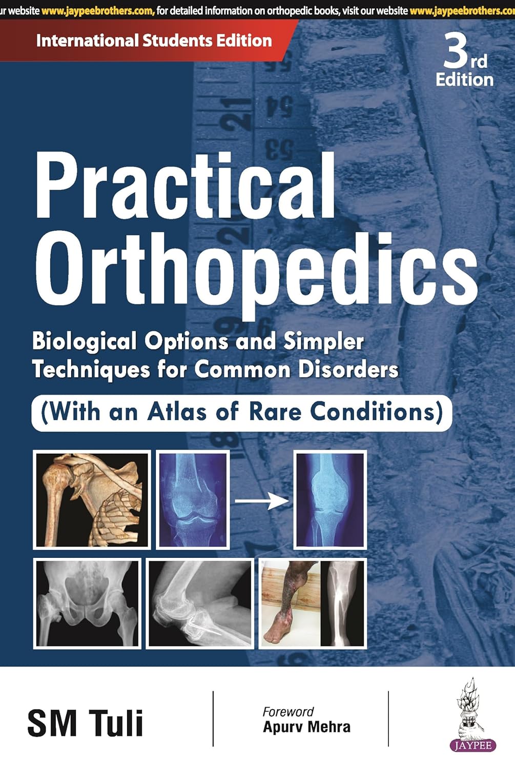 PRACTICAL ORTHOPEDICS: BIOLOGICAL OPTIONS AND SIMPLER TECHNIQUES FOR COMMON DISORDERS (WITH AN ATLAS 3RD/2026 - SM TULI