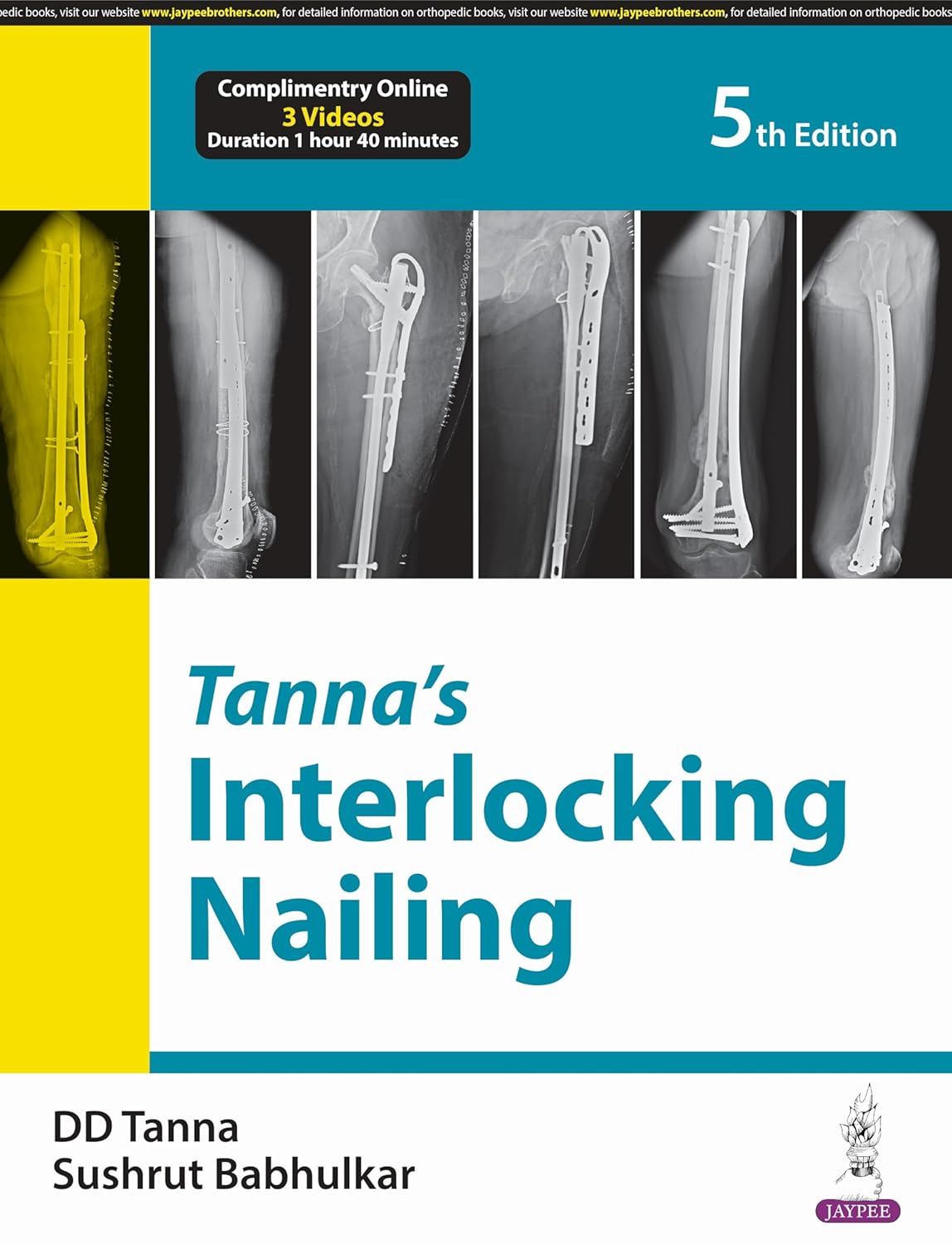 TANNA'S INTERLOCKING NAILING 5TH/2024 - DD TANNA