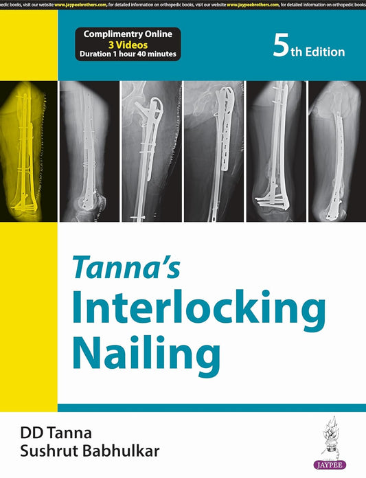 TANNA'S INTERLOCKING NAILING 5TH/2024 - DD TANNA