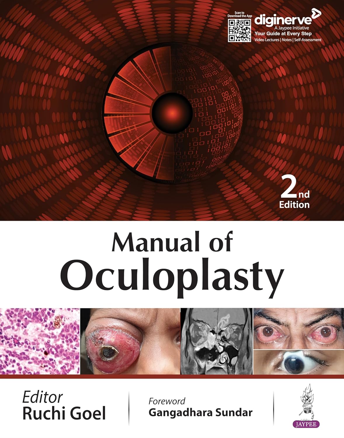 MANUAL OF OCULOPLASTY 2ND/2026 - RUCHI GOEL