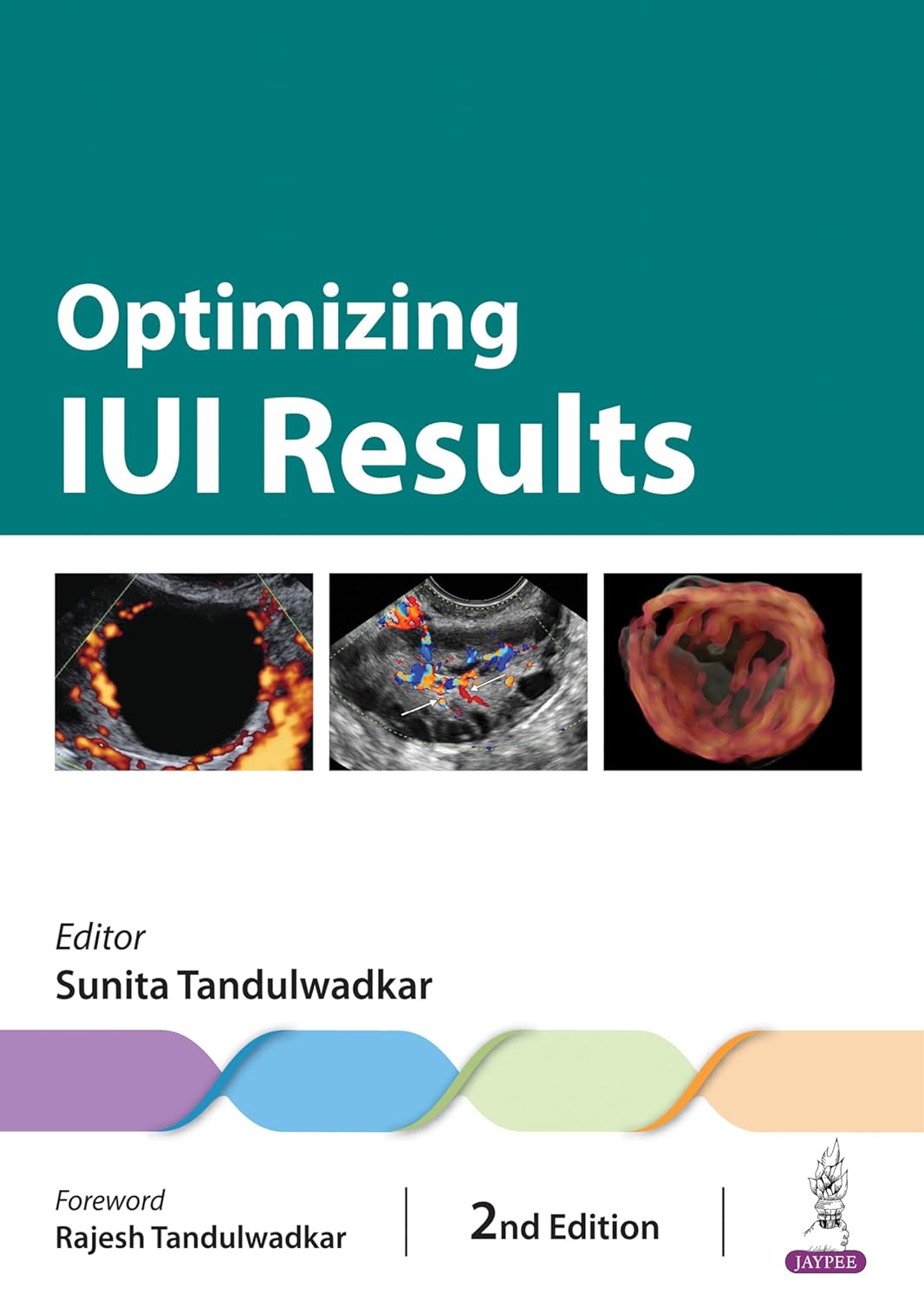 OPTIMIZING IUI RESULTS 2ND/2024 - SUNITA TANDULWADKAR