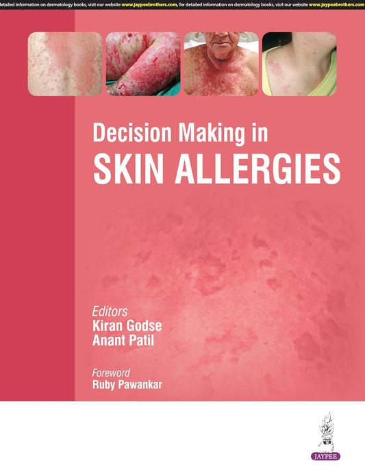 DECISION MAKING IN SKIN ALLERGIES 1ST/2025 - KIRAN GODSE