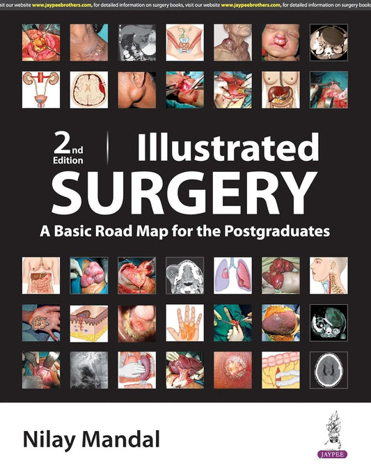 ILLUSTRATED SURGERY A BASIC ROAD MAP FOR THE POSTGRADUATES 2ND/2024 - NILAY MANDAL