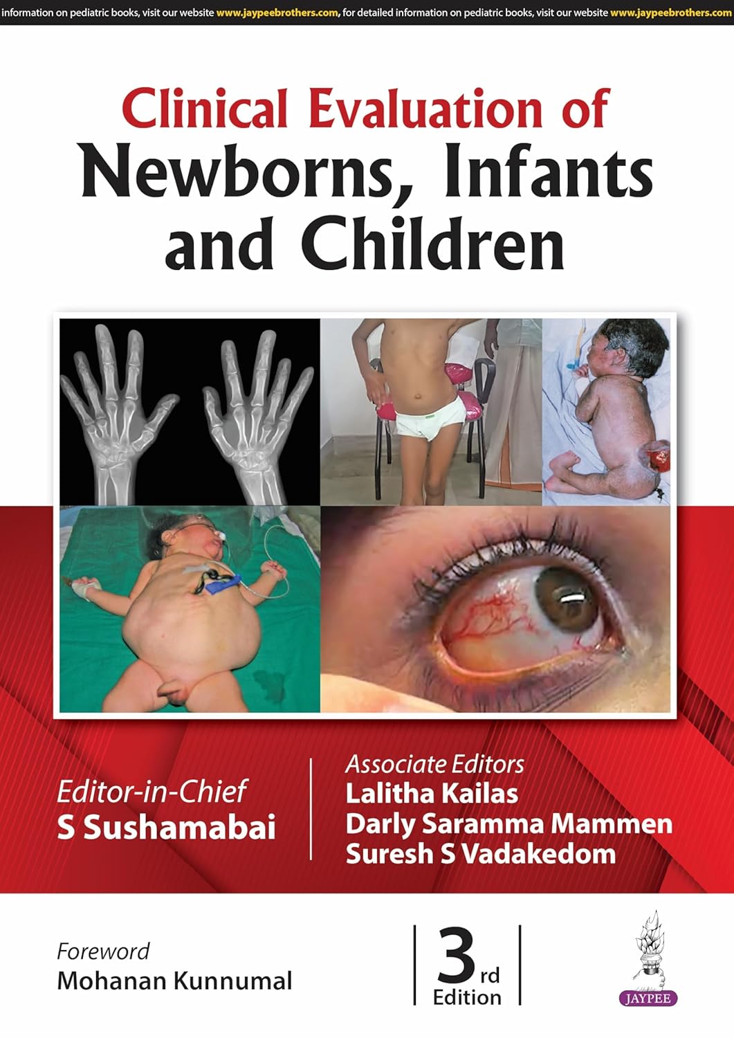 CLINICAL EVALUATION OF NEWBORNS, INFANTS AND CHILDREN 3RD/2025 - S SUSHAMABAI