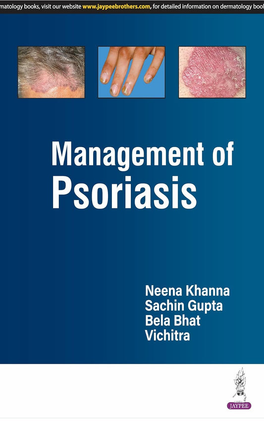 MANAGEMENT OF PSORIASIS 1ST/2025 - NEENA KHANNA