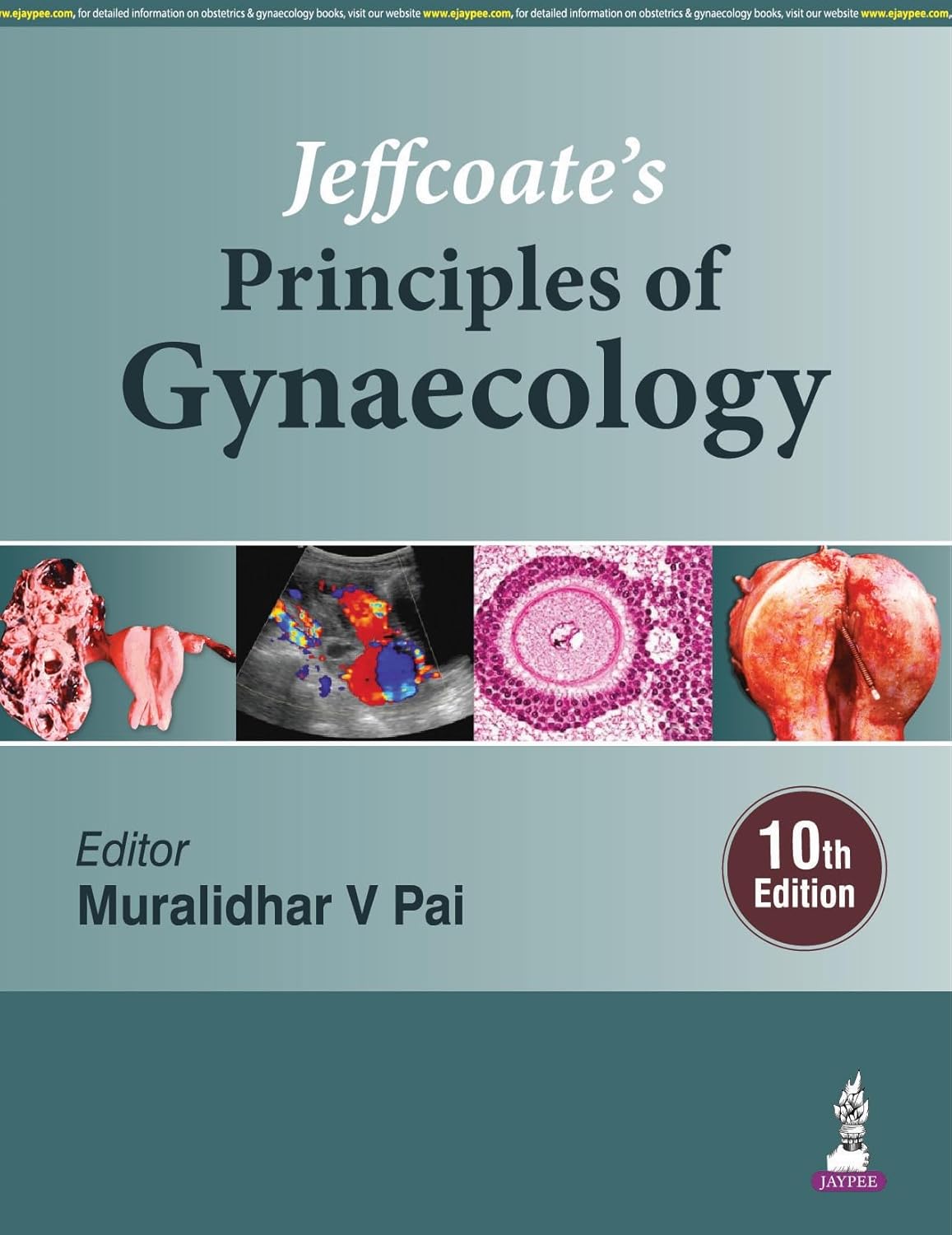 JEFFCOATE'S PRINCIPLES OF GYNAECOLOGY 10TH/2026 - MURALIDHAR V PAI