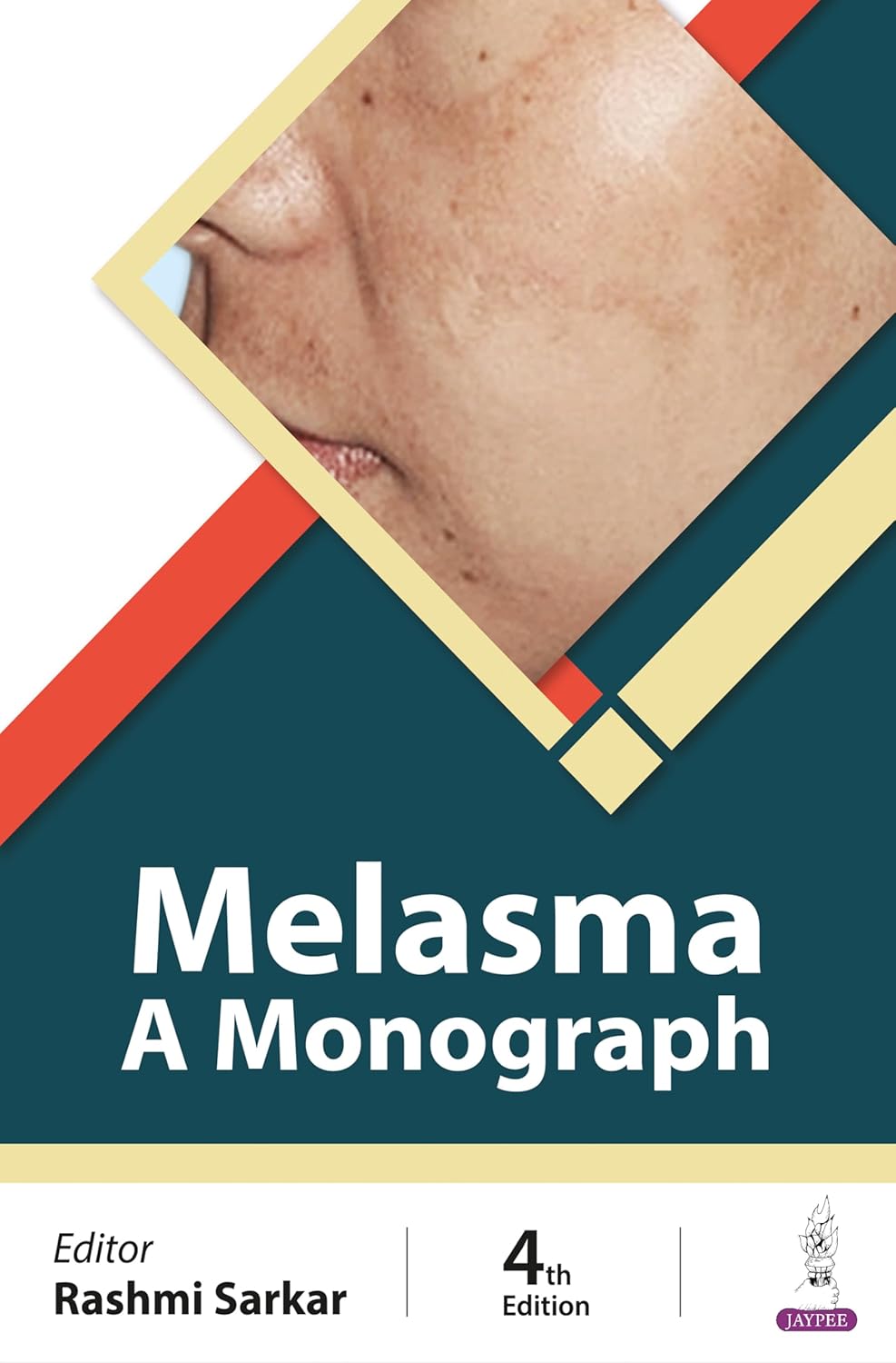 MELASMA: A MONOGRAPH 4TH/2024 - RASHMI SARKAR