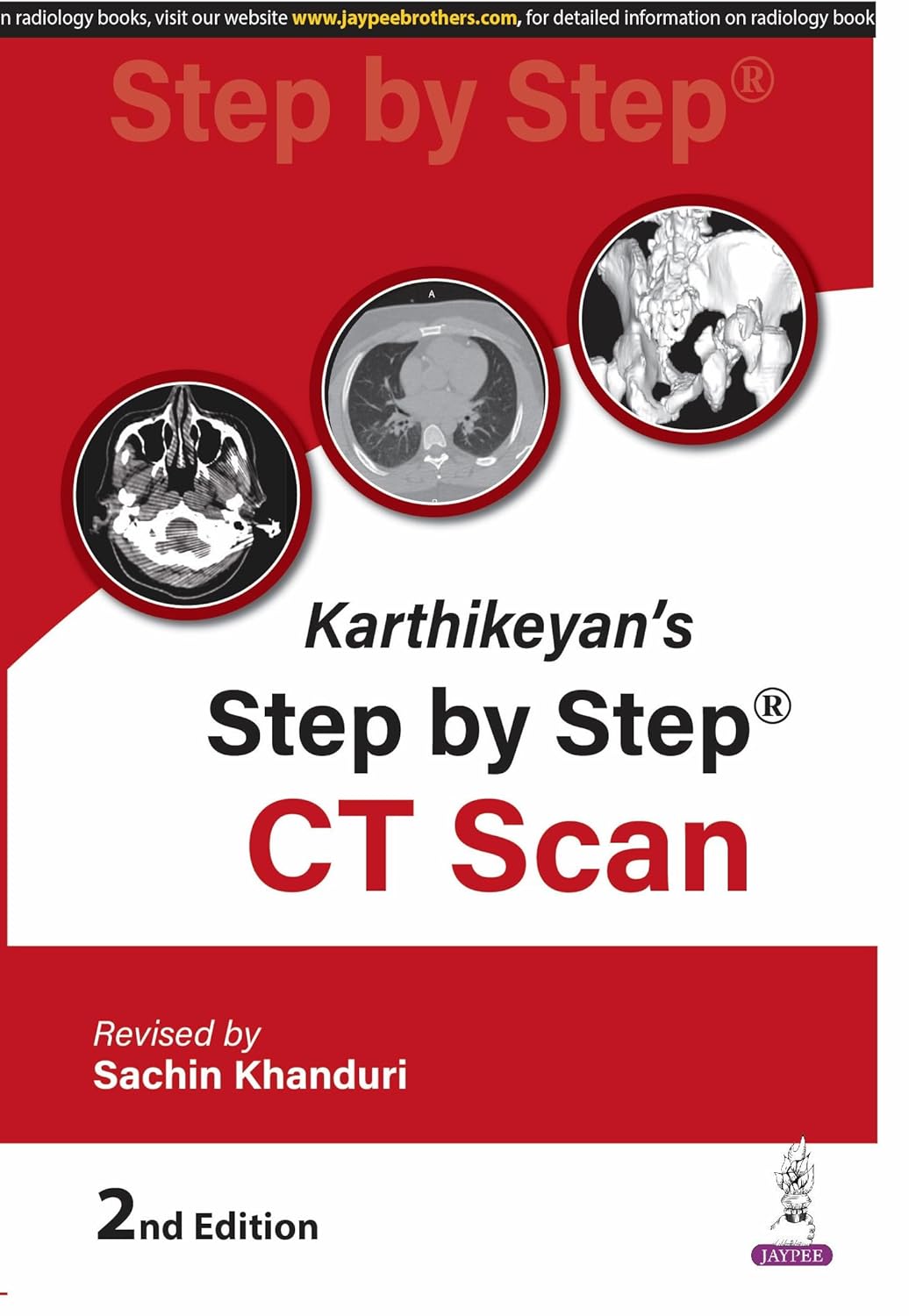 KARTHIKEYAN'S STEP BY STEP CT SCAN 2ND/2026 - SACHIN KHANDURI