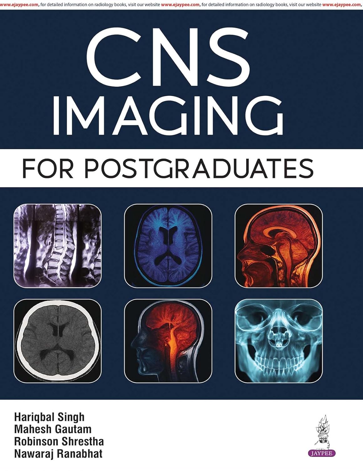 CNS IMAGING FOR POSTGRADUATES 1ST/2026 - HARIQBAL SINGH