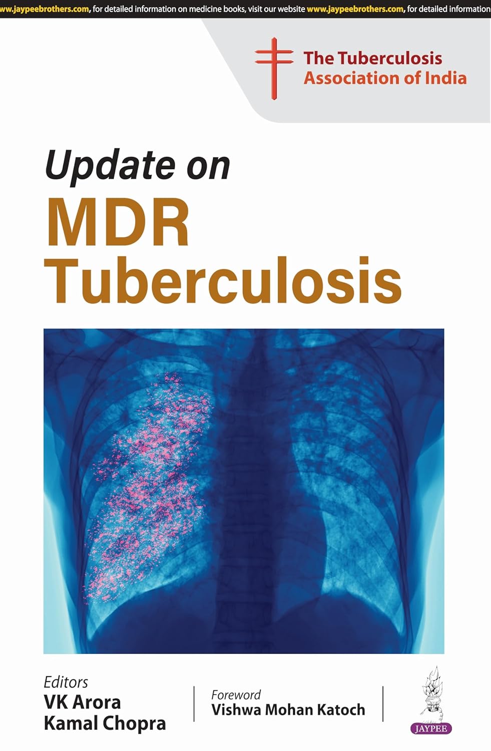 UPDATE ON MDR TUBERCULOSIS 1ST/2025 - VK ARORA