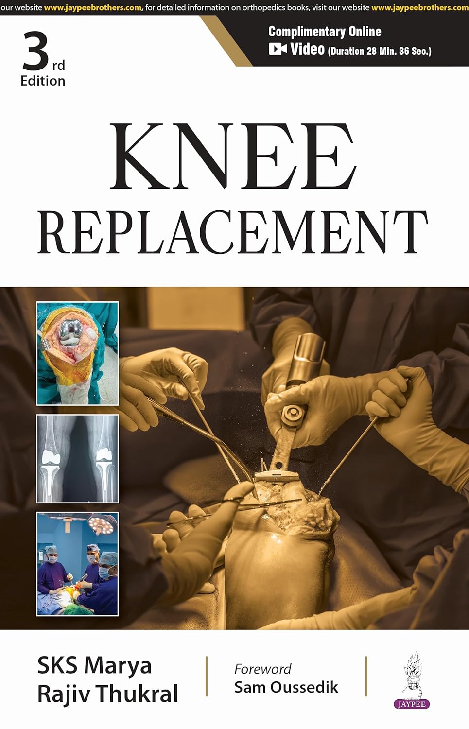 KNEE REPLACEMENT 3RD/2025 - SKS MARYA