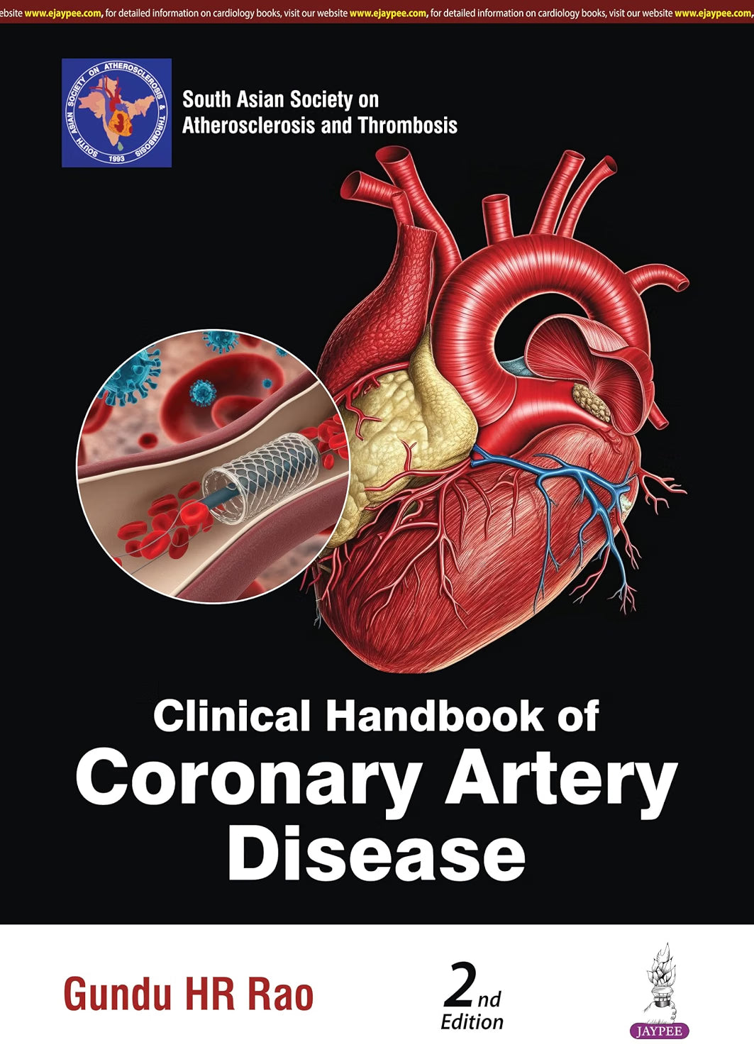 CLINICAL HANDBOOK OF CORONARY ARTERY DISEASES 2ND/2027- GUNDU HR RAO