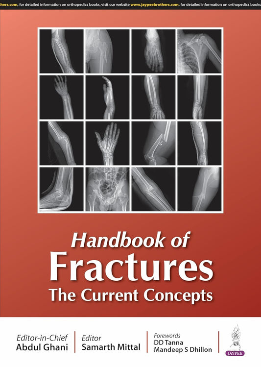 HANDBOOK OF FRACTURES THE CURRENT CONCEPTS 1ST/2025 - ABDUL GHANI
