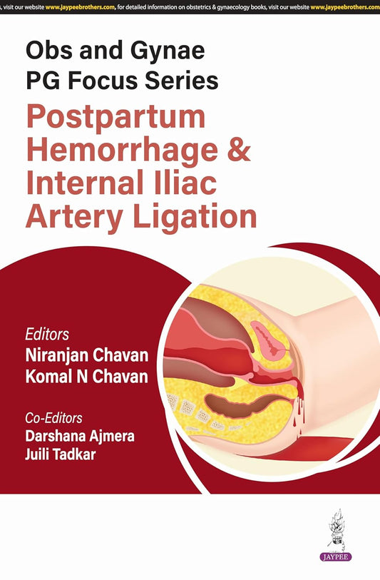 OBS AND GYNAE PG FOCUS SERIES POSTPARTUM HEMORRHAGE & INTERNAL ILIAC ARTERY LIGATION 1ST/2025 - KOMAL N CHAVAN