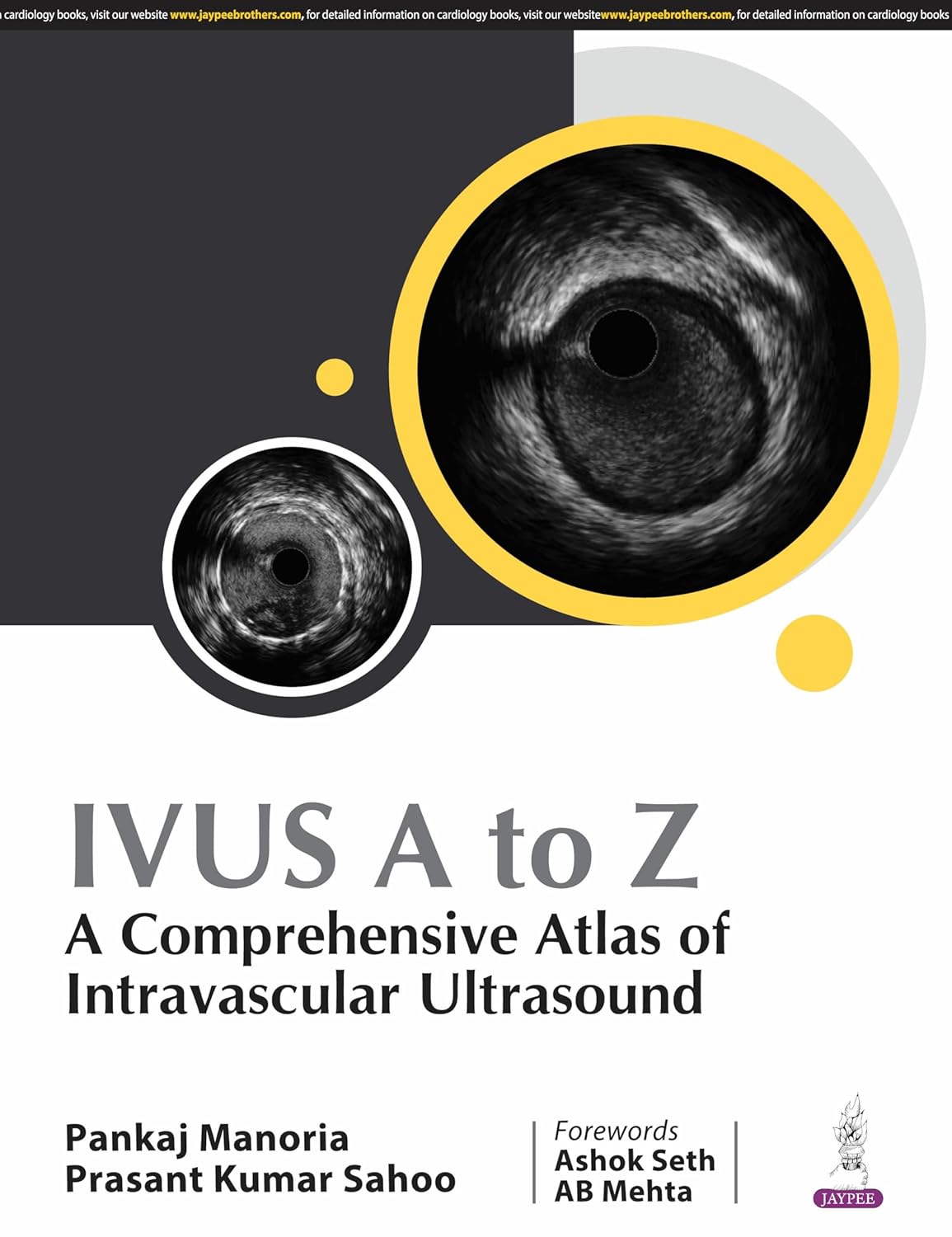 IVUS A TO Z : A COMPREHENSIVE ATLAS OF INTRAVASCULAR ULTRASOUND 1ST/2025 - PANKAJ MANORIA